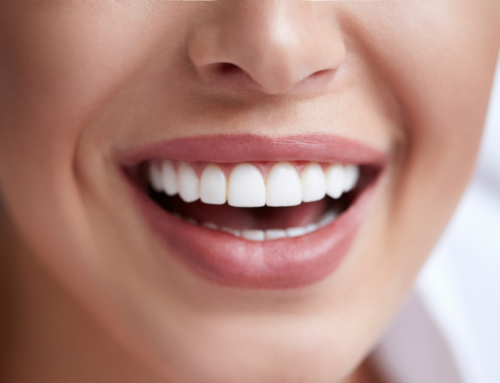 Why Choose Professional Teeth Whitening In Raleigh?