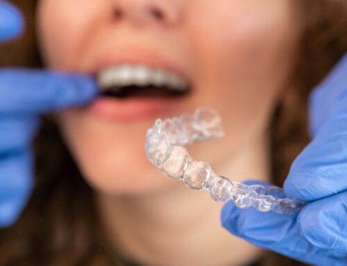 Why Invisalign Is Raleigh NC’s Preferred Orthodontic Solution