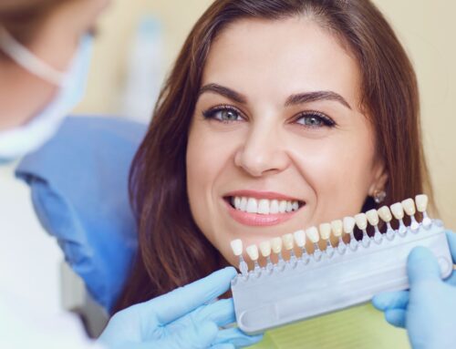 Teeth Whitening In Raleigh: How To Maintain Bright Smiles Between Professional Treatments